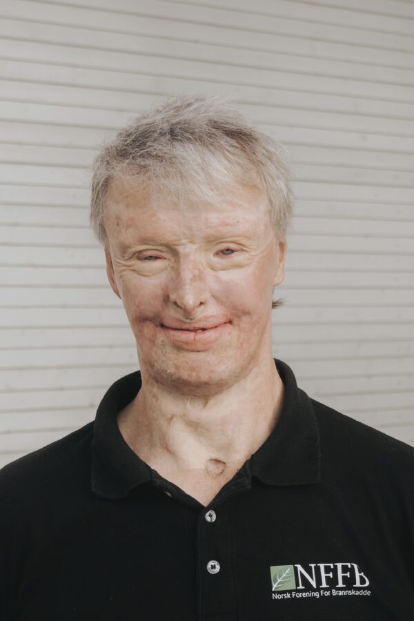 Håvard Lystad